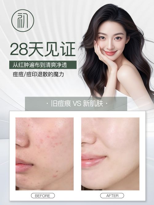 十大高分好评祛痘品牌效果显著AG真人app认证的祛痘产品(图5)